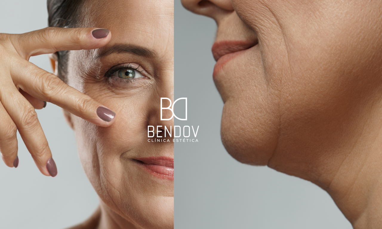Armonización facial